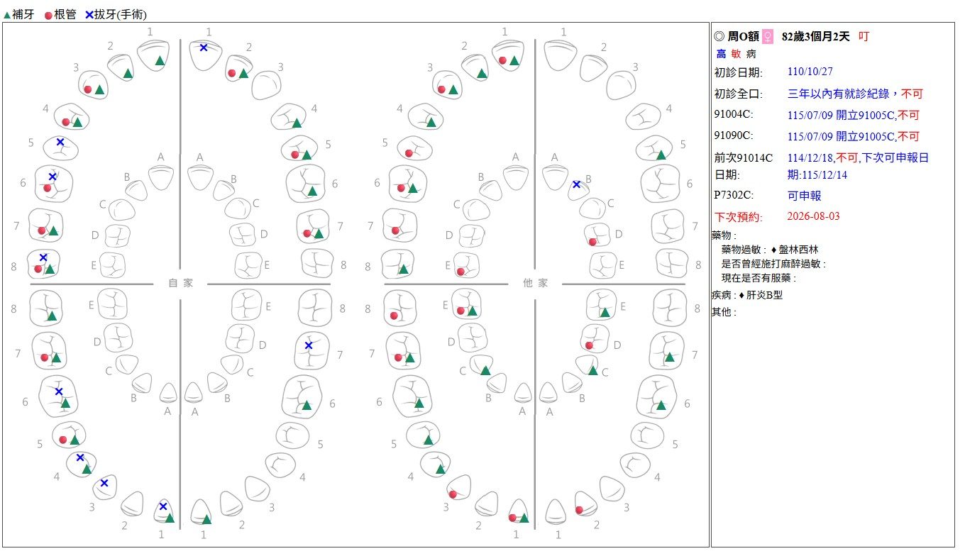 全口牙位圖——補牙、根管、拔牙處置紀錄完整呈現